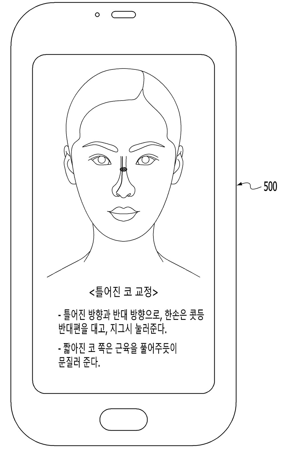 “얼굴 성형 교정에 사용되는 장치”의 도면